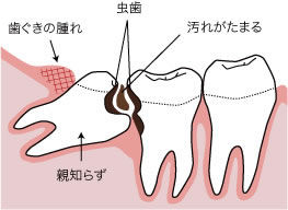 歯医者